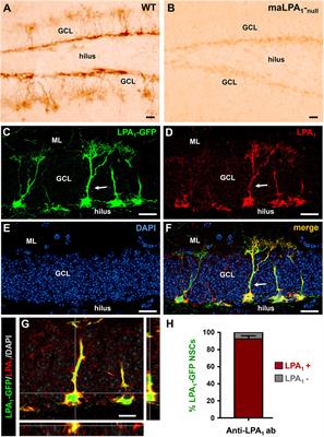 Lysophosphatidic Acid Receptor 1 Specifically Labels Seizure-Induced Hippocampal Reactive Neural Stem Cells and Regulates Their Division